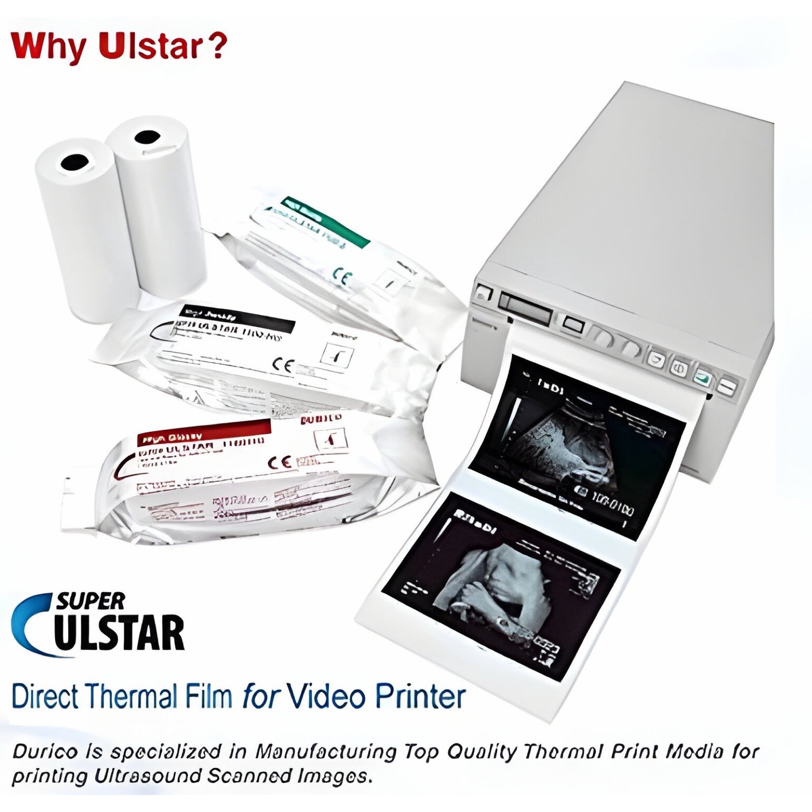 Durico 1100HG High-Gloss Ultrasound Thermal Paper (5 Rolls)